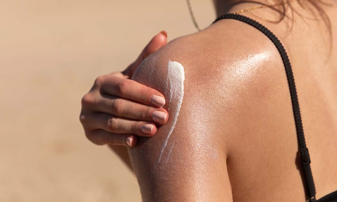 5 cuidados com a pele no verão