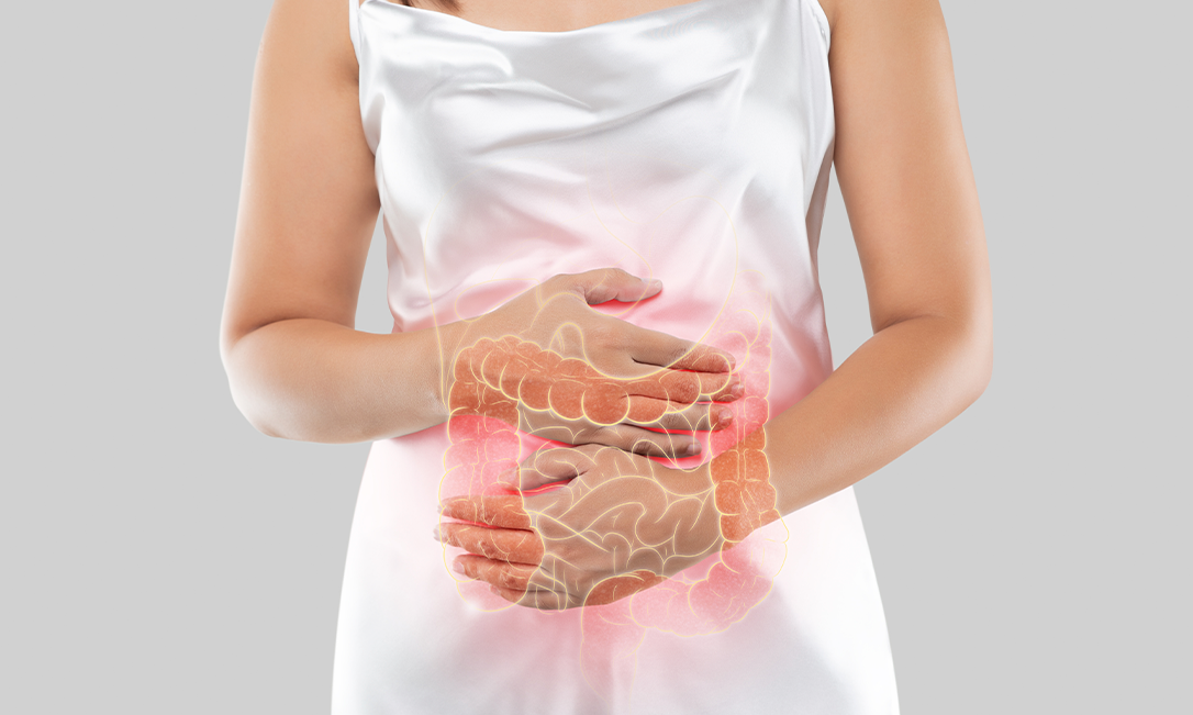 Câncer de intestino: sintomas, causas, diagnóstico e tratamento