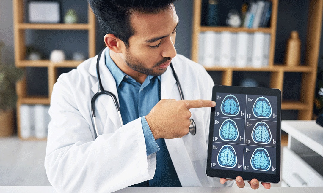 Câncer de cérebro: conheça os tipos e os sinais de alerta