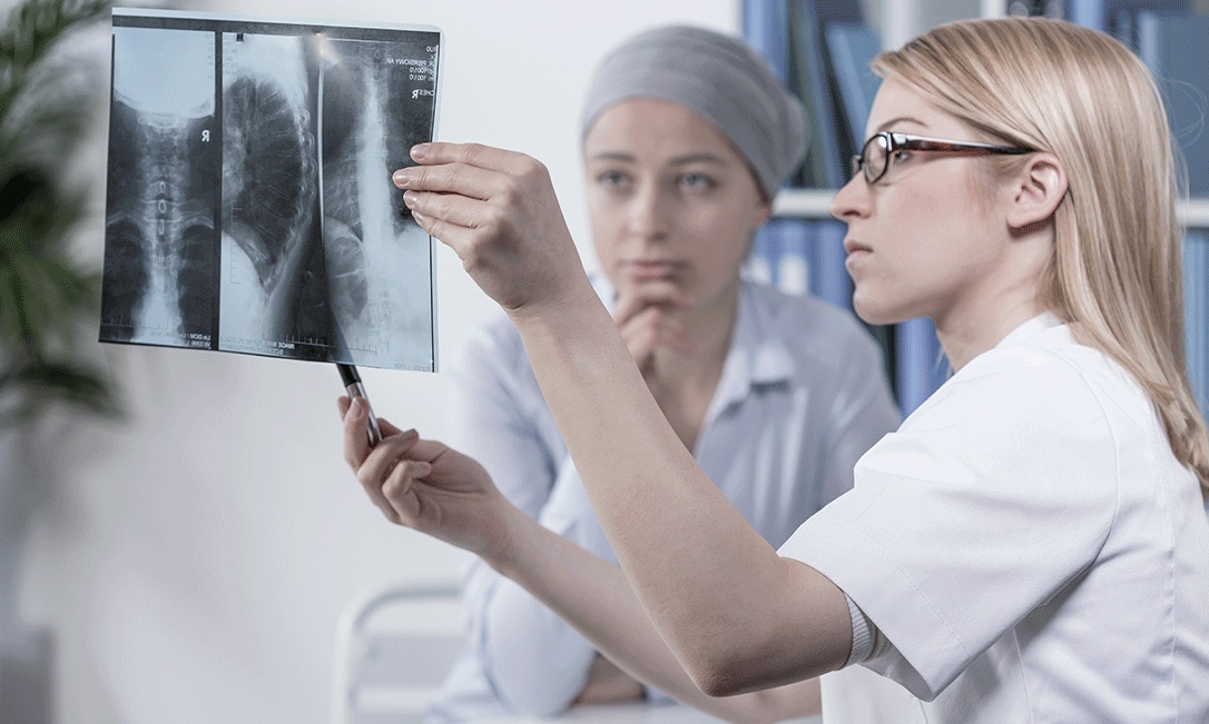 Entenda o que é metástase e por que o câncer se espalha