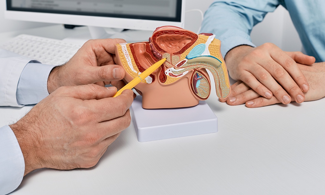 Entendendo a neoplasia maligna da próstata