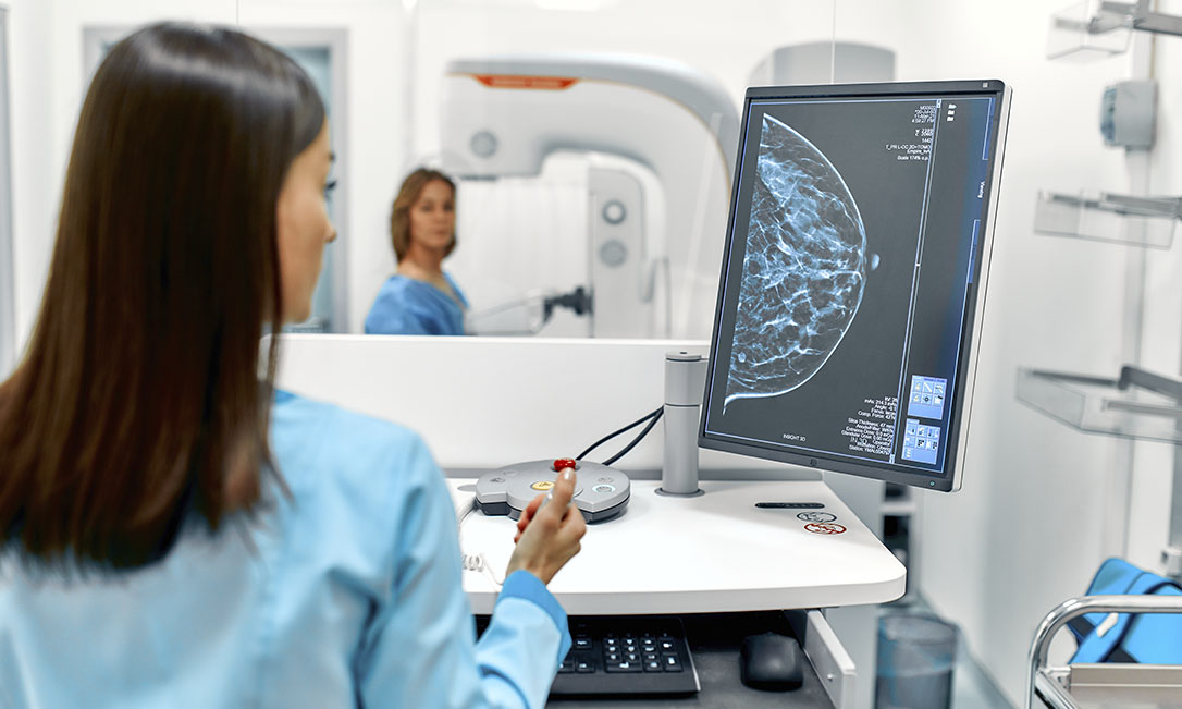 Entendendo a neoplasia maligna da mama