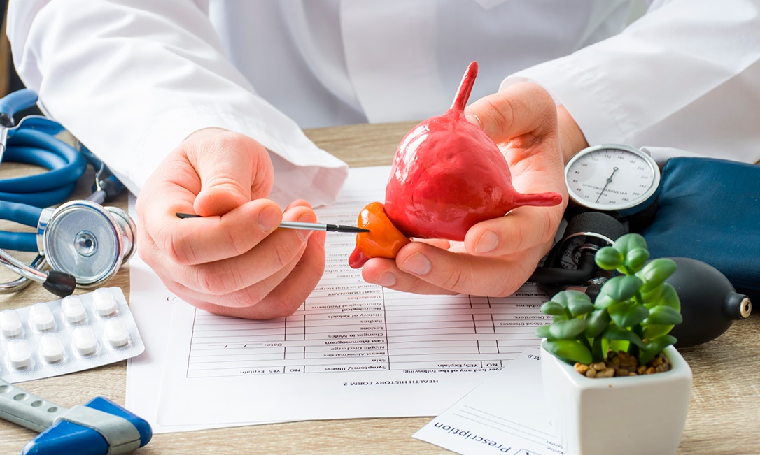 O que causa câncer de próstata?