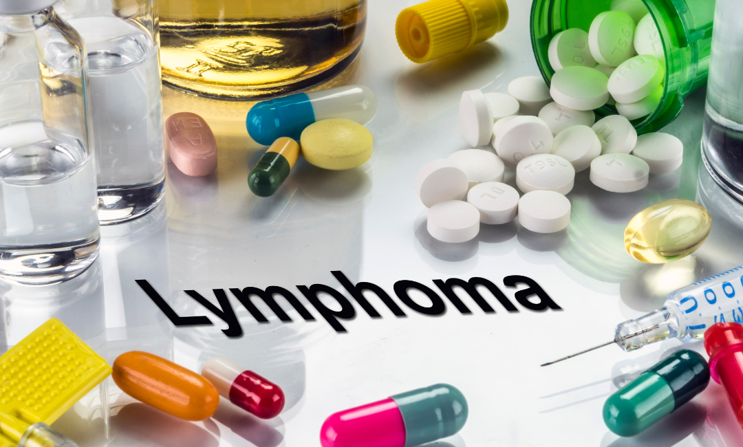 O que são linfomas e como identificá-los precocemente?
